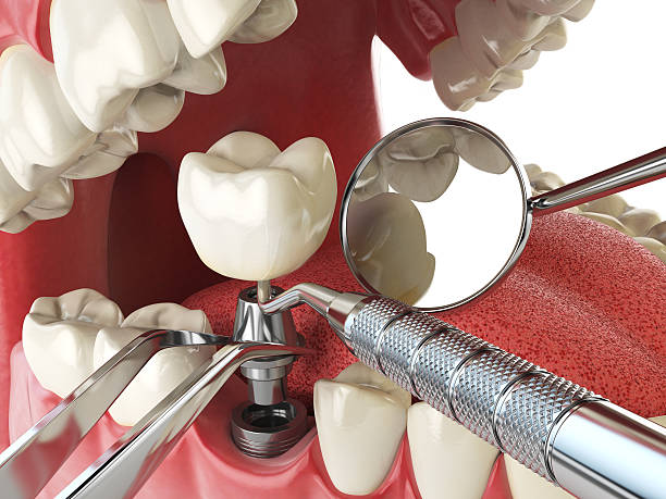 Best Emergency Dental Care for Trauma or Injury in Winterset, IA