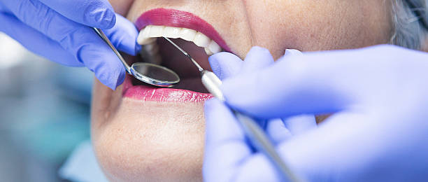Best Emergency Wisdom Teeth Removal in Winterset, IA